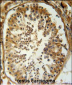 SRAC1 Antibody  (C-term)
